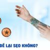 Xóa xăm có để lại sẹo không? Khi nào nên lựa chọn?