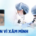 Hối hận vì xăm mình