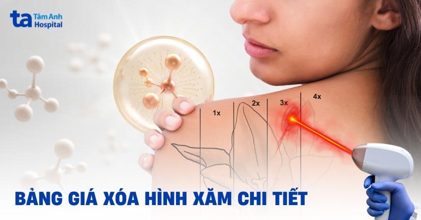 xăm vòng tay nhật cổ bao nhiêu tiền