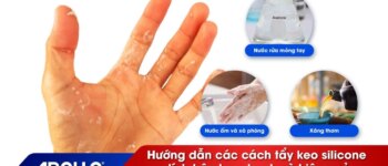 Hướng dẫn các cách tẩy keo silicone dính trên tay nhanh và hiệu quả