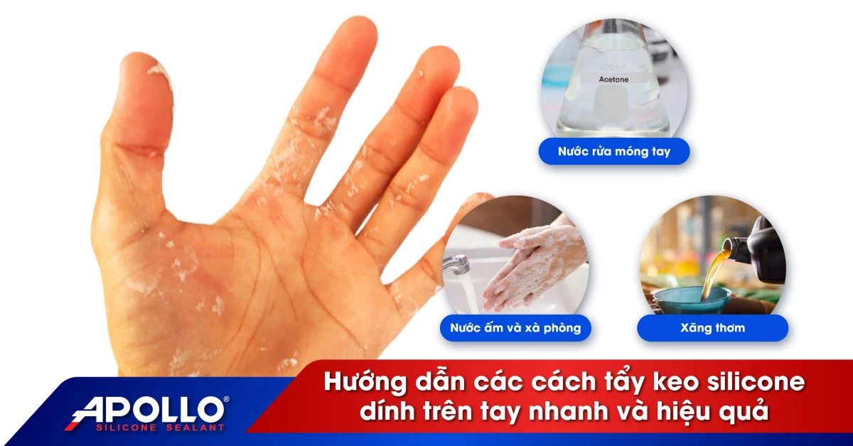 bị keo dính vào tay