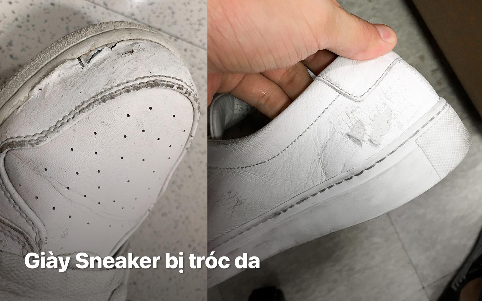 giày sneaker bị tróc da